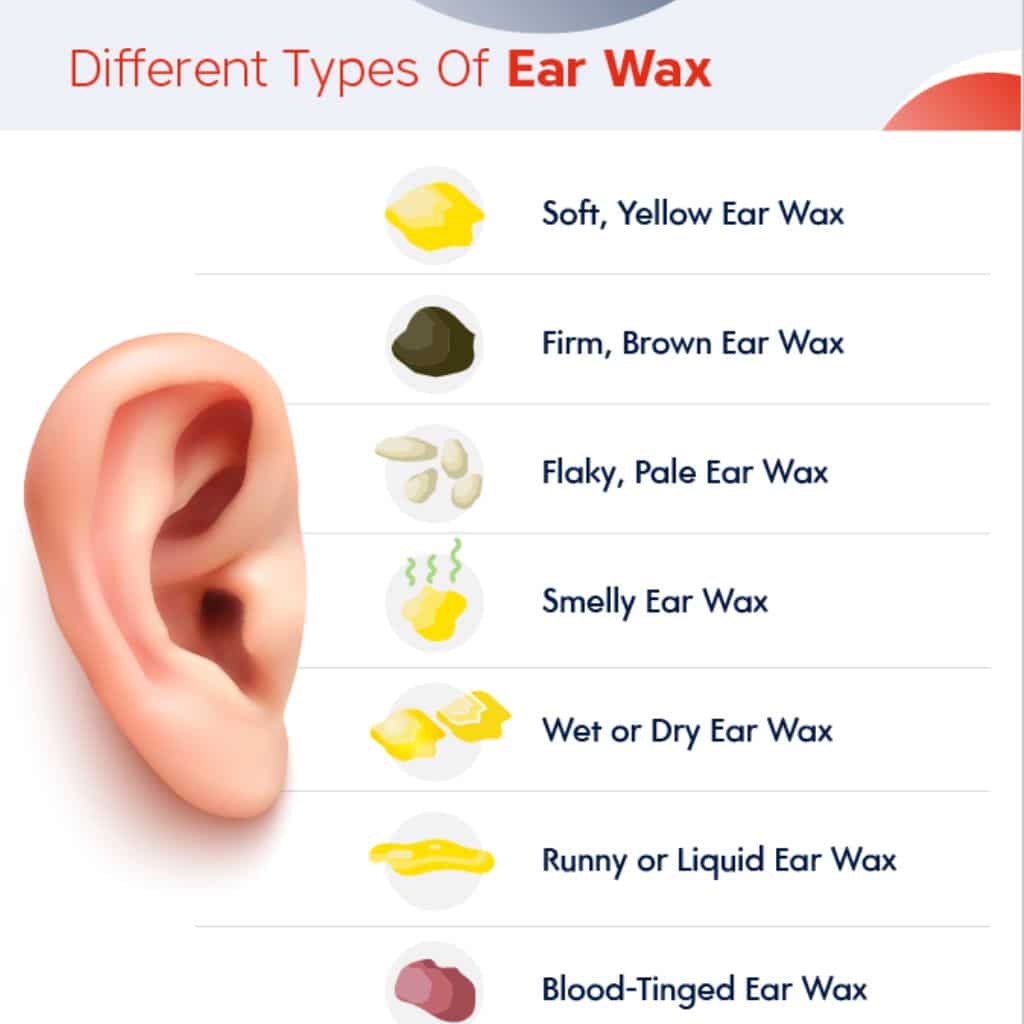 types of earwax graphic