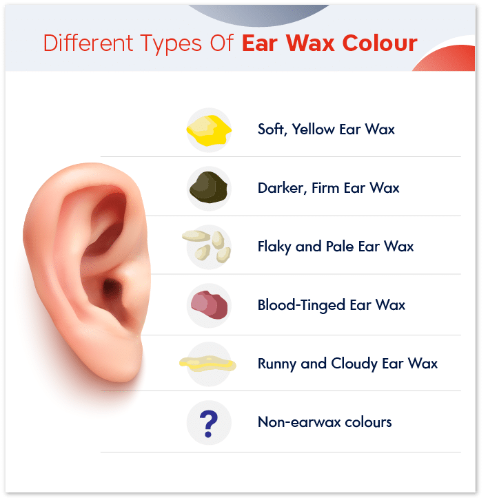 types of earwax