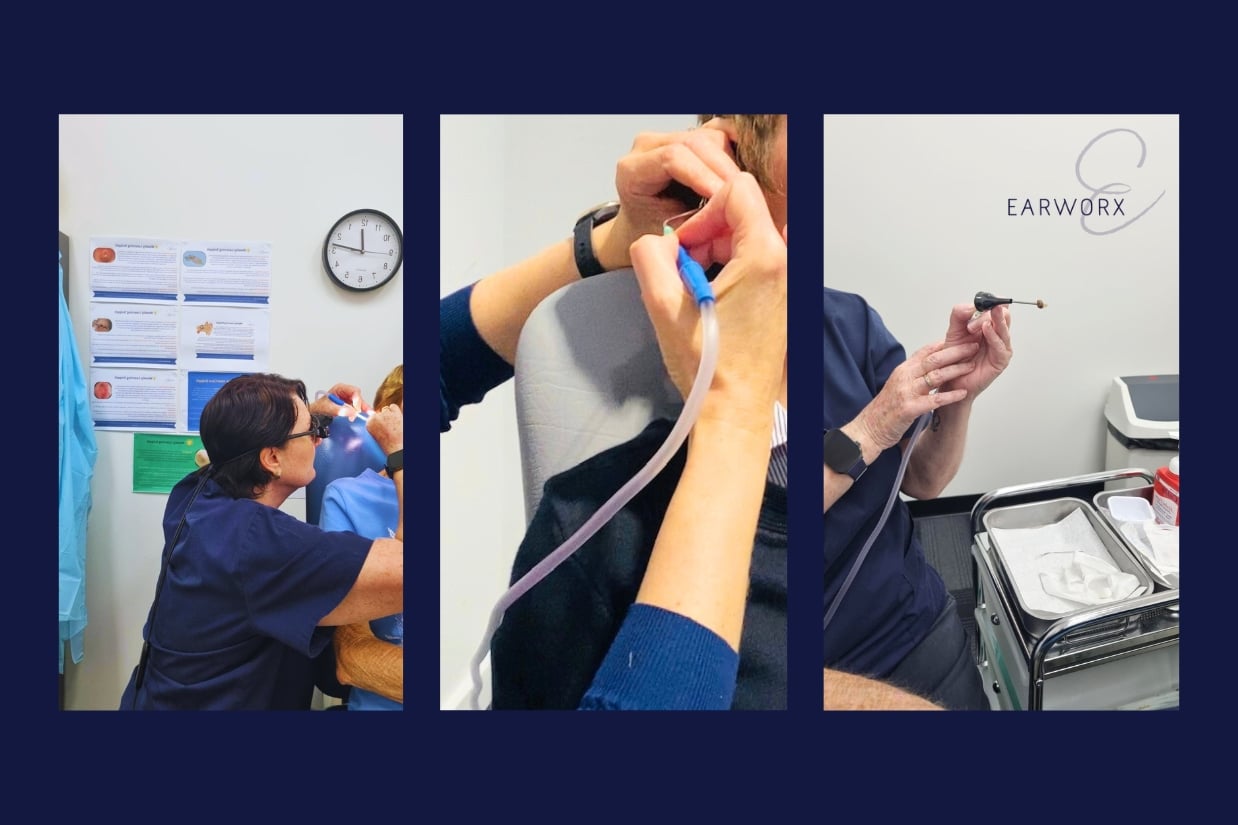 Professional earwax removal process using micro-suction