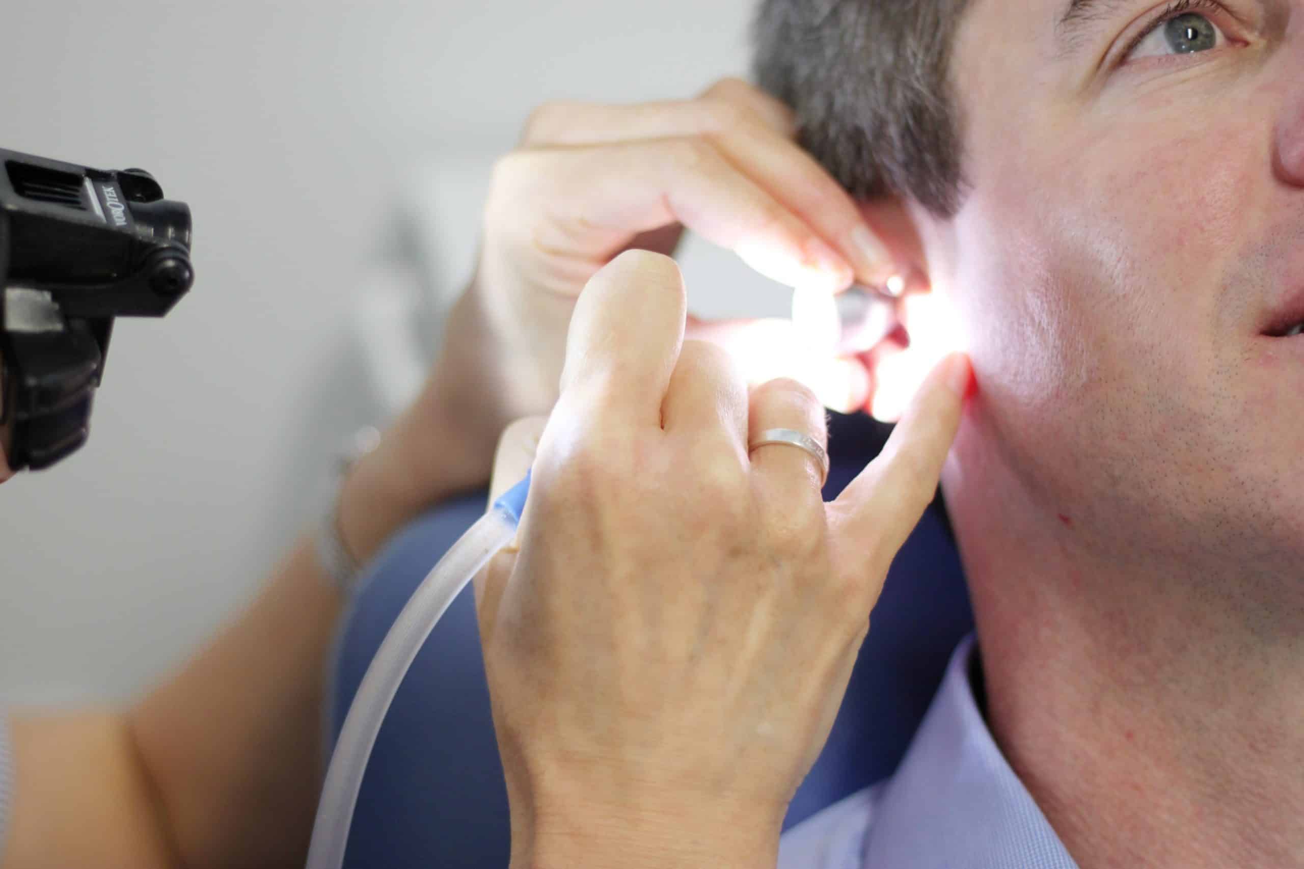 Registered Nurse performs microsuction earwax removal on a man’s ear using magnifying loupes and a fine suction tube
